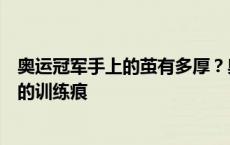 奥运冠军手上的茧有多厚？奥运冠军孙梦雅向记者展示手上的训练痕