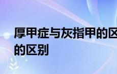 厚甲症与灰指甲的区别视频 厚甲症与灰指甲的区别 